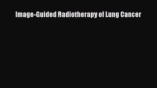 Download Image-Guided Radiotherapy of Lung Cancer PDF Online