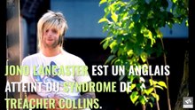 Ce jeune mannequin souffre d’une maladie génétique rare et tient à faire passer un beau message !