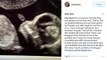 Pregnant Blac Chyna Posts Sonogram Of Her and Rob Kardashian's Baby