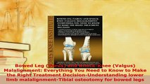 Read  Bowed Leg Varus and KnockKnee Valgus Malalignment Everything You Need to Know to Ebook Free