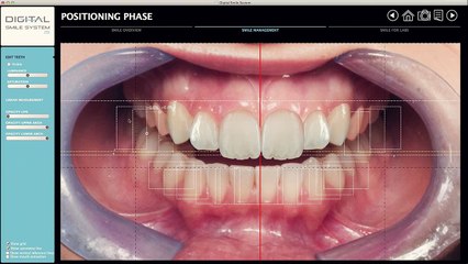 DSS - Diary Of A Smile