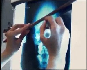 Öldürücü Cazibe | Belgesel