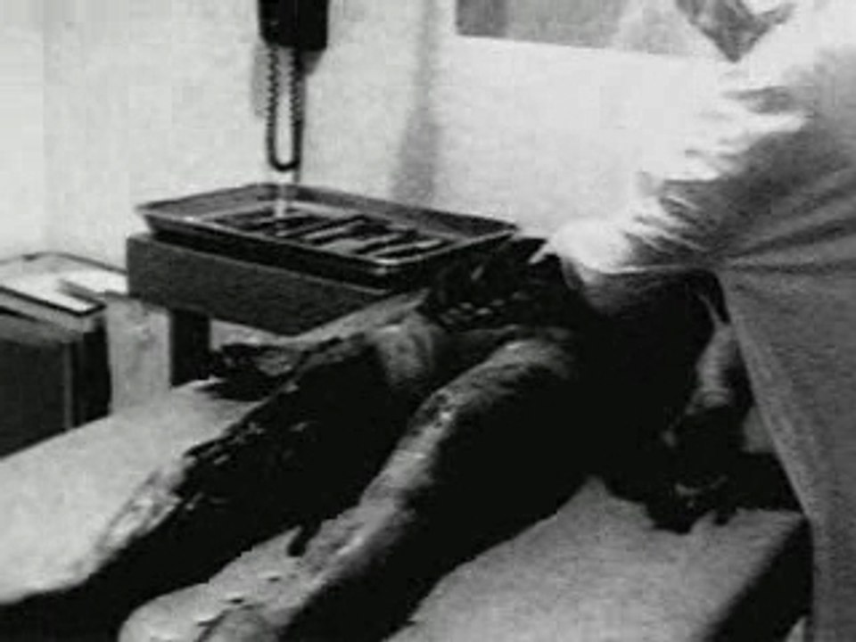 Alien Autopsy - Roswell Crash