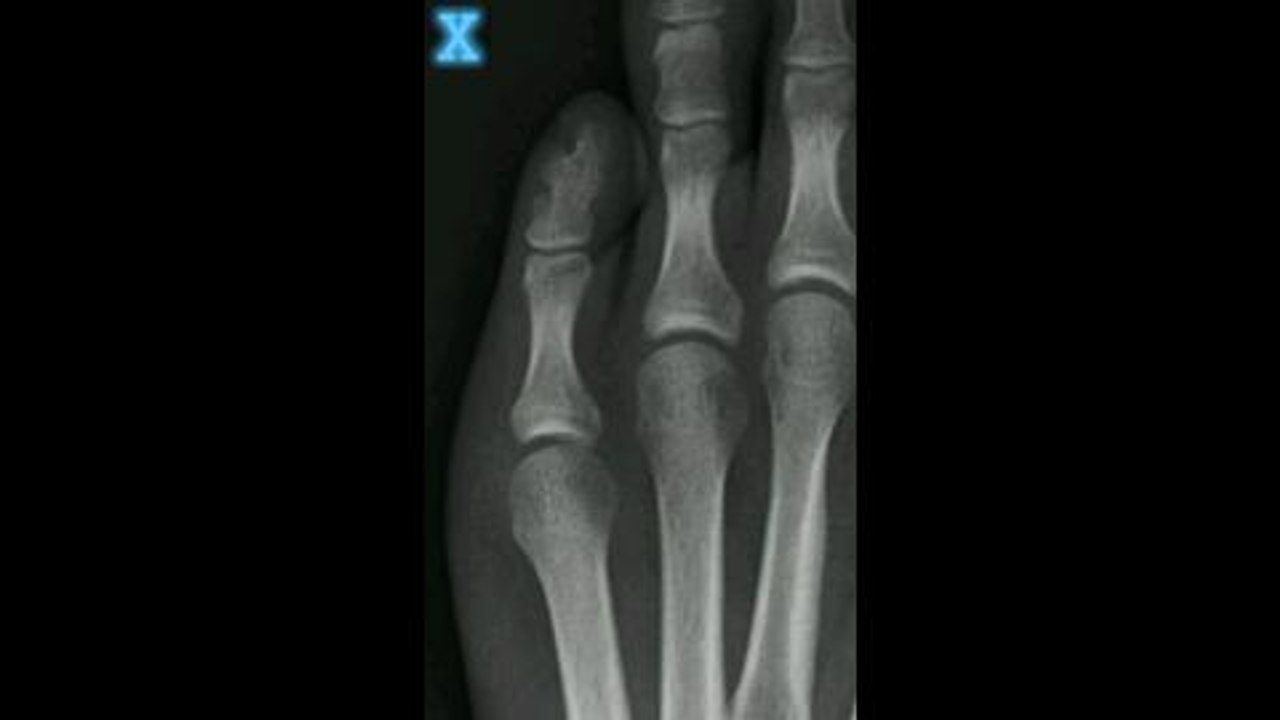 X-Ray Scanner