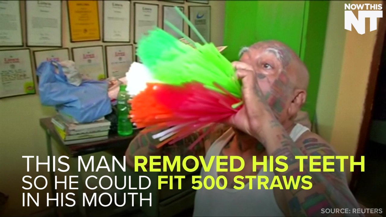 Guinness Rishi Had All His Teeth Removed So He Could Break A Guinness World Record