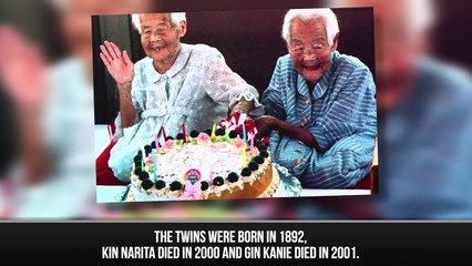 10 Unusual Twins You Wont Believe Exist