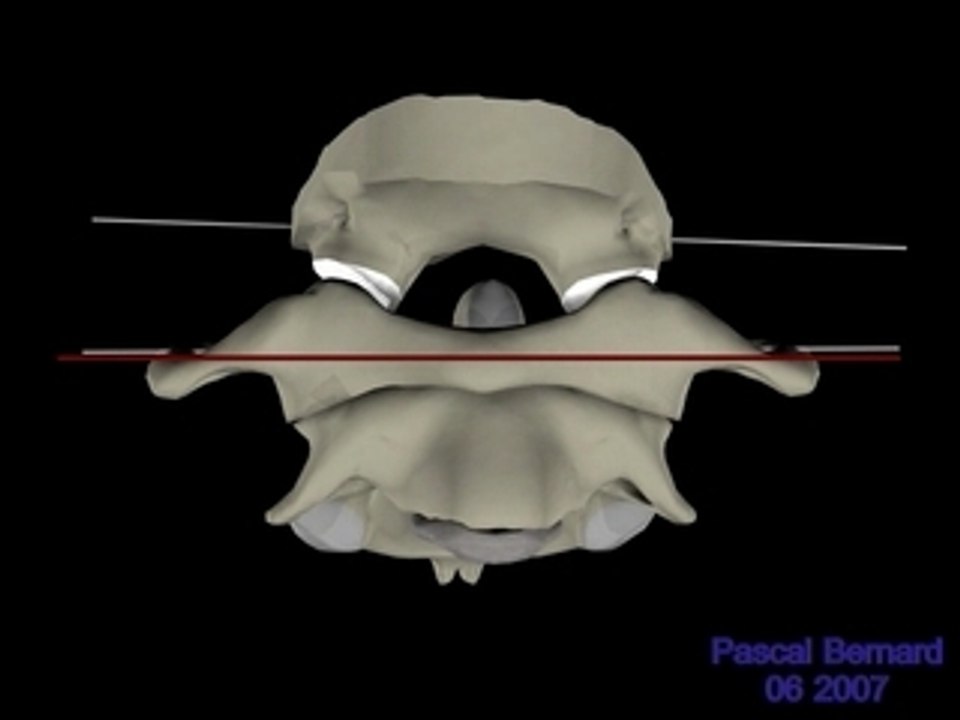 Rotation RCS IL C1 et C0 vue de face