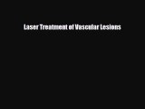 Download Laser Treatment of Vascular Lesions Ebook Online
