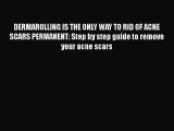 Read DERMAROLLING IS THE ONLY WAY TO RID OF ACNE SCARS PERMANENT: Step by step guide to remove