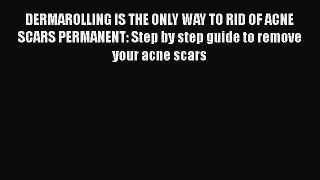 Read DERMAROLLING IS THE ONLY WAY TO RID OF ACNE SCARS PERMANENT: Step by step guide to remove