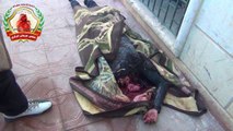 حلب حريتان : استشهاد شابة بسبب القصف 19/12/2013