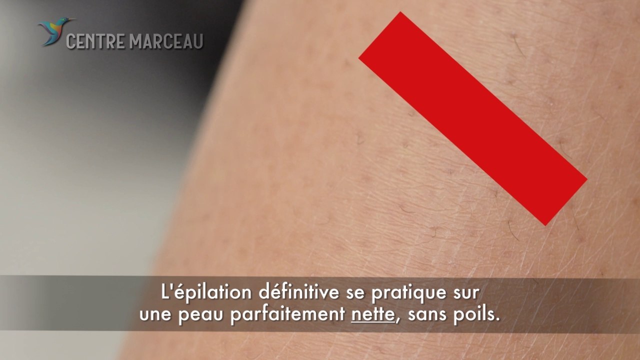 Epilation laser definitive - Le rasage