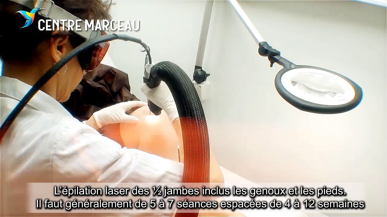 Epilation laser des jambes chez une femme | Centre Marceau Paris