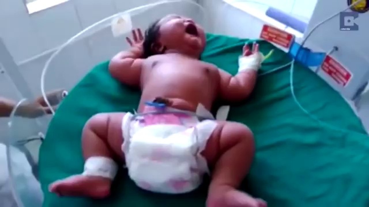 Une indienne donne naissance à une petite fille pesant 6,8 kg, la plus lourde du monde !