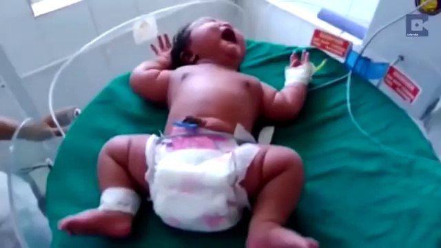 Une indienne donne naissance à une petite fille pesant 6,8 kg, la plus lourde du monde !