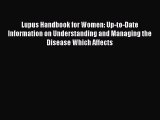READ book Lupus Handbook for Women: Up-to-Date Information on Understanding and Managing the