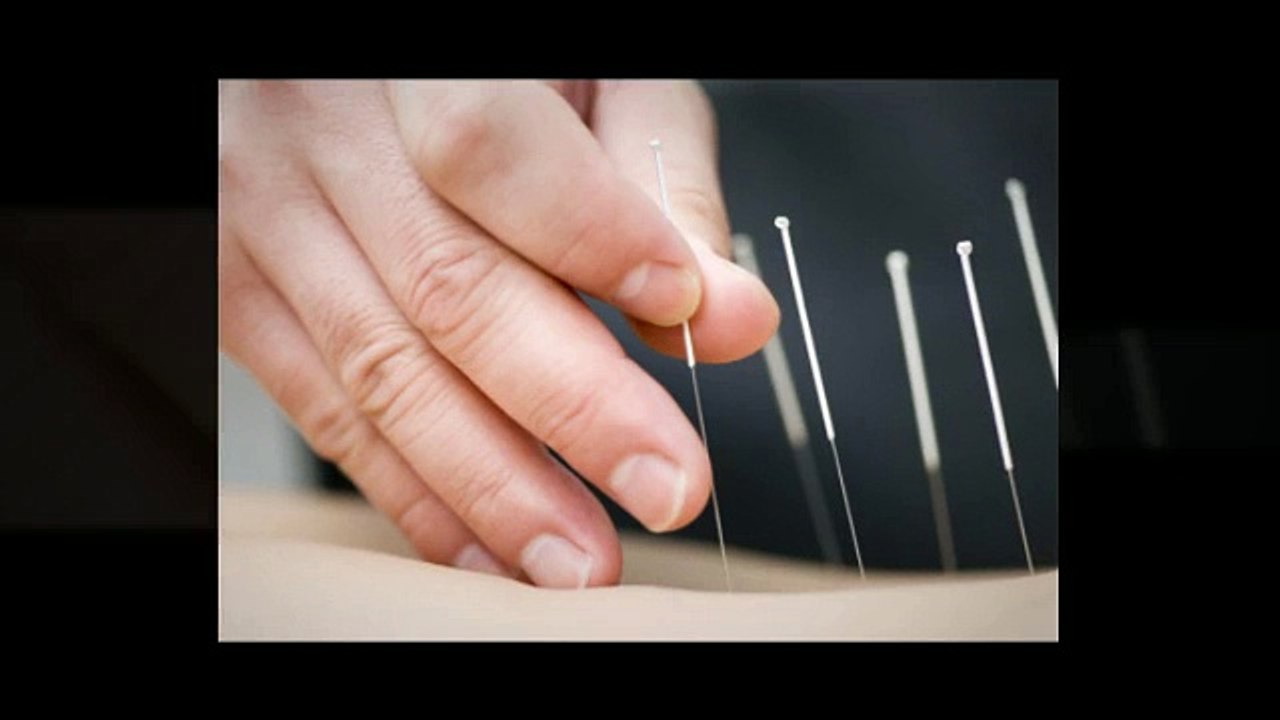 Acupuncture Dubai