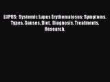 READ book LUPUS:  Systemic Lupus Erythematosus: Symptoms. Types. Causes. Diet.  Diagnosis.