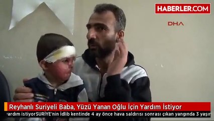 Reyhanlı Suriyeli Baba, Yüzü Yanan Oğlu İçin Yardım İstiyor