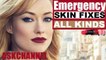 Emergency Skin Fixes! Blackheads, Dry Patches, Oiliness and Pimples!  2016