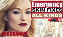 Emergency Skin Fixes! Blackheads, Dry Patches, Oiliness and Pimples!  2016