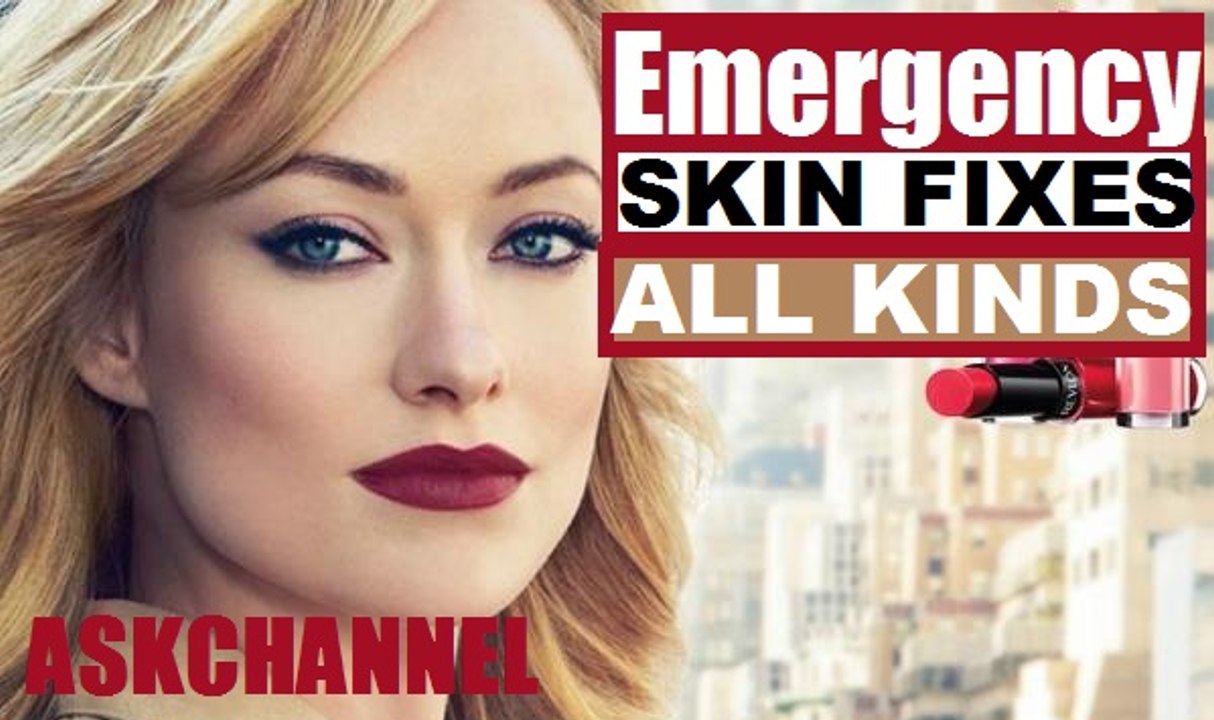 Emergency Skin Fixes! Blackheads, Dry Patches, Oiliness and Pimples!  2016