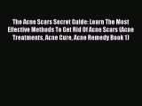 READ book The Acne Scars Secret Guide: Learn The Most Effective Methods To Get Rid Of Acne