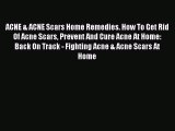 READ book ACNE & ACNE Scars Home Remedies. How To Get Rid Of Acne Scars Prevent And Cure Acne