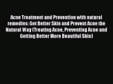 READ book Acne Treatment and Prevention with natural remedies: Get Better Skin and Prevent