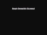 READ book Atopic Dematitis (Eczema)# Full Free