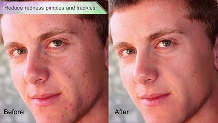 portrait skin retouching