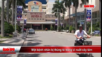 Một bệnh nhân bị thủng tá tràng vì nuốt cây tăm