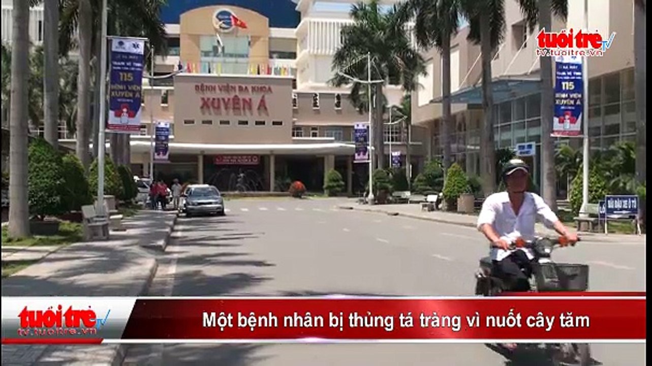 Một bệnh nhân bị thủng tá tràng vì nuốt cây tăm