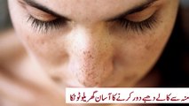 mu se kaly dhaby door krny ka gharelu totka- home remedy to remove dark spots from face