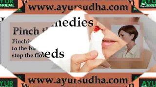 Home Remedies For Nosebleeds