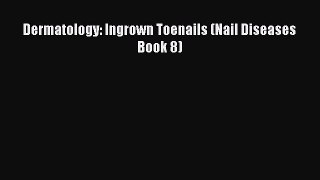 Read Dermatology: Ingrown Toenails (Nail Diseases Book 8) Ebook Free