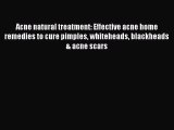 Read Acne natural treatment: Effective acne home remedies to cure pimples whiteheads blackheads