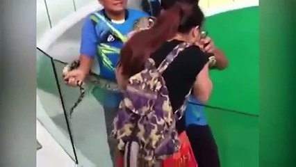 Snake bites girl trying to kiss him