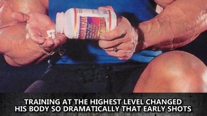 10 Most Extreme Bodybuilding Transformations Ever