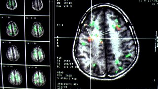 Brain Technology Interfaces in The Eternal Sunshine of the Spotless Mind