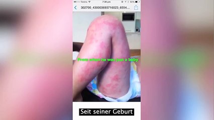 Elle est obligée de filmer son fils parce que les médecins ne la croient pas