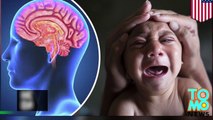 Zika outbreak - How does the Zika virus damage the brain - TomoNews