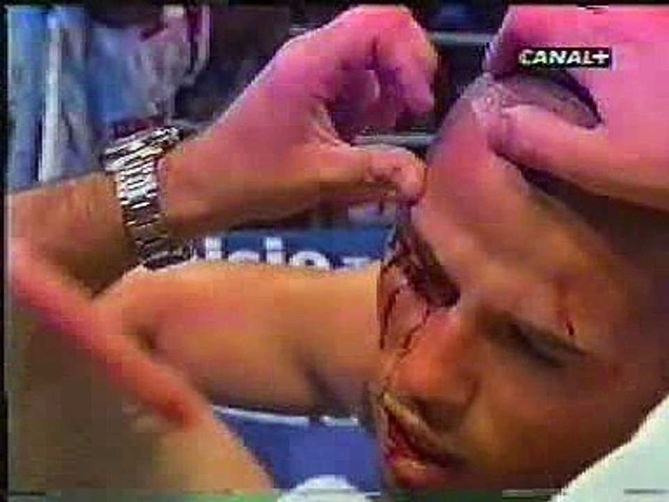 Mike Zambidis worst moments