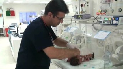 Şanlıurfa Aynı Karaciğeri Paylaşan Siyam İkizleri Dünyaya Geldi