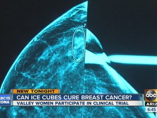 Can ice cubes cure breast cancer?