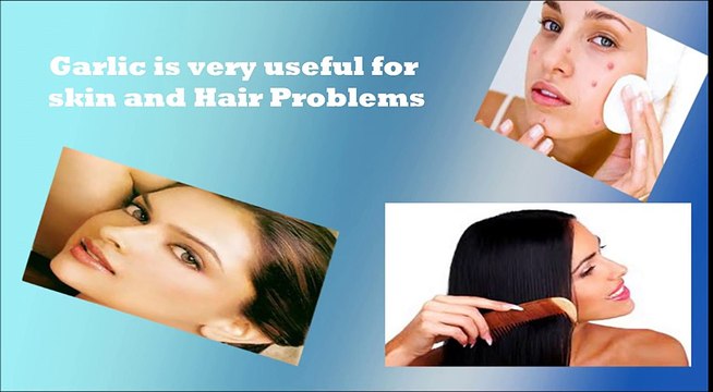 Benefits of Garlic for weight loss, Acne, Hair and Cholesterol (Hindi)