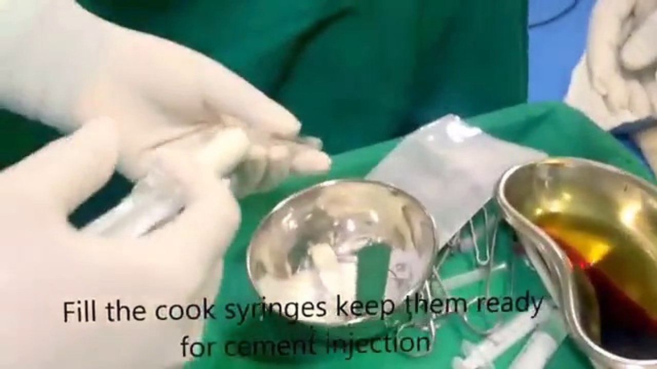 Percutaneous Vertebroplasty
