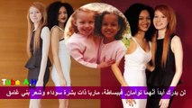 اغرب حالات التوائم لن تصدق انهم موجودين 1993