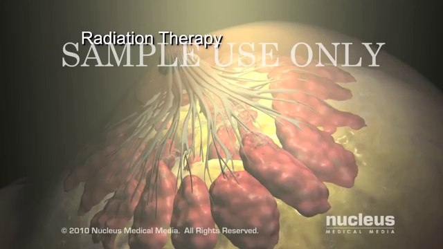 Breast Cancer best treatment | breast cancer awareness women save and happily life | Learn2Way 2016