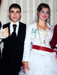 Kocasının Benzin Döküp Yaktığı Kadın Öldü